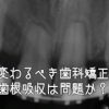 変わるべき歯科矯正：歯根吸収は問題か？